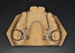 歯の内側からの矯正